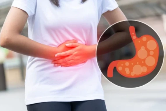 Flatulence: Causes, Symptoms, Prevention, and Treatment