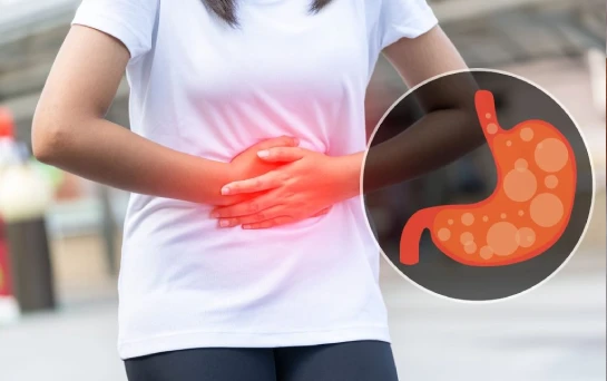 Flatulence: Causes, Symptoms, Prevention, and Treatment